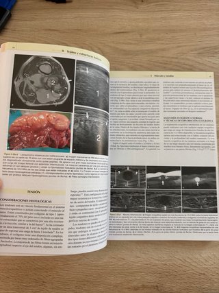 Ecografía musculoesquelética Generalidades, tej...