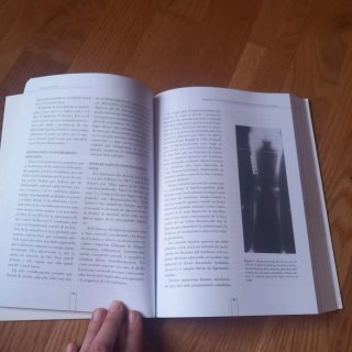 Fracturas infantiles conceptos y principios