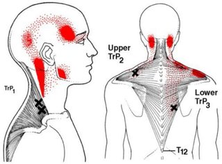 Quiromasaje, masaje deportivo readapatación lesion