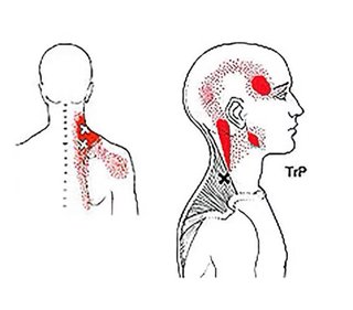 Quiromasaje, masaje deportivo readapatación lesion