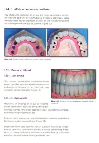 ODONTOLOGIA [3 LIBROS]. IMPLANTES. PRTOTESIS.