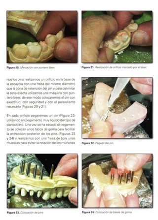 ODONTOLOGIA [3 LIBROS]. IMPLANTES. PRTOTESIS.