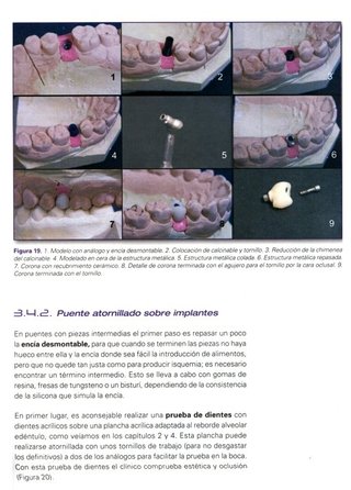 ODONTOLOGIA [3 LIBROS]. IMPLANTES. PRTOTESIS.