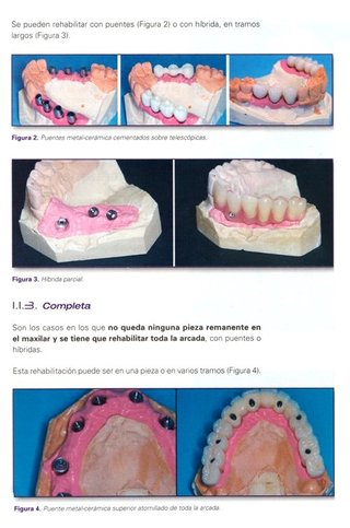 ODONTOLOGIA [3 LIBROS]. IMPLANTES. PRTOTESIS.