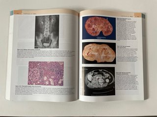 Robbins Atlas anatomía patológica. Libros medicina