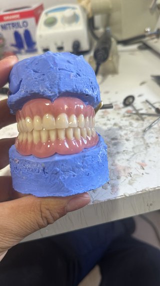 Prótesis dental superior e inferior