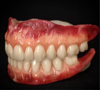 Prótesis dental superior e inferior