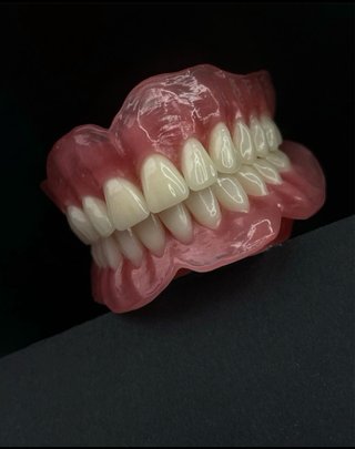 Prótesis dental completa superior
