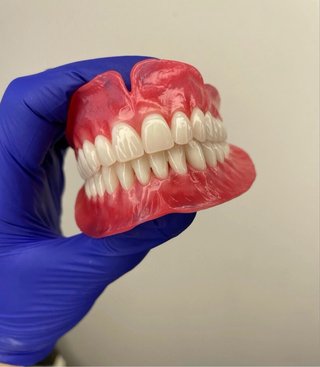 Prótesis dental completa superior