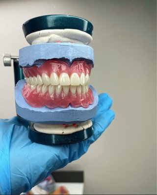 Prótesis dental completa superior