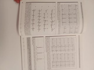 Libro La electrocardiografía de la cardiopatía isq