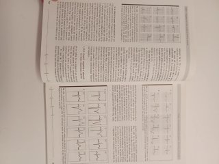 Libro La electrocardiografía de la cardiopatía isq