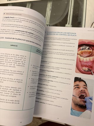 Libro Higiene Bucodental. Ilerna. Intervención