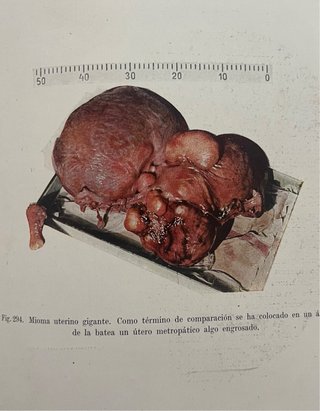 Vendo libros de Ginecologia, Medica y Ojos. Aniguo