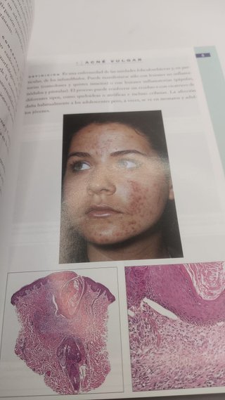 Dermatología de bolsillo