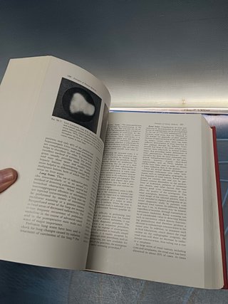 libro, Cancer medicine James F.Holland