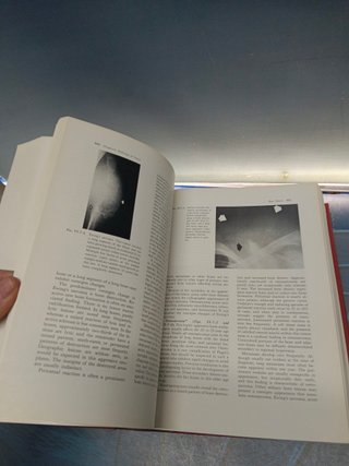 libro, Cancer medicine James F.Holland