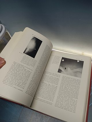 libro, Cancer medicine James F.Holland