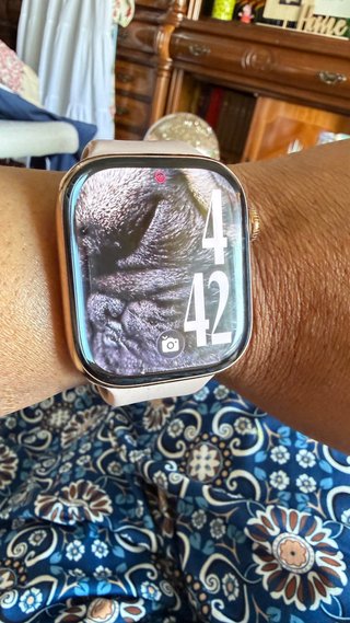 Apple Watch Series 10 GPS + Cellular