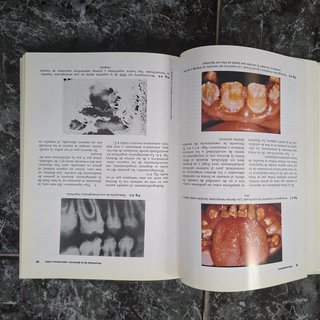 Odontopediatría