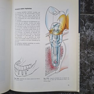 LA BOCA / Dientes y tratamiento dental