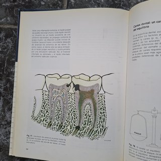 LA BOCA / Dientes y tratamiento dental