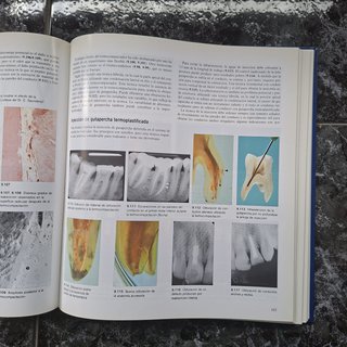 Atlas en color de ENDODONCIA