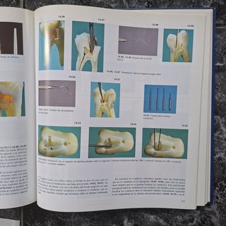 Atlas en color de ENDODONCIA