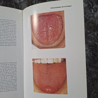 Atlas de enfermedades de la mucosa oral (4ª edició