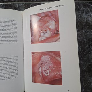 Atlas de enfermedades de la mucosa oral (4ª edició
