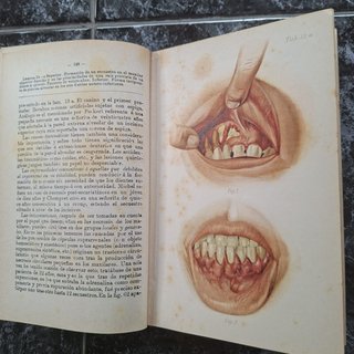 Atlas y Tratado  de Odontología y Estomatología