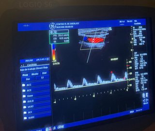 Ultrasonido GE Logiq S6