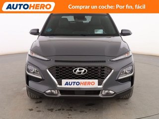 Hyundai Kona 1.6 CRDi Tecno Red 2WD