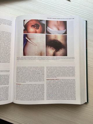 Nelson. Tratado de Pediatría, Volumen 2