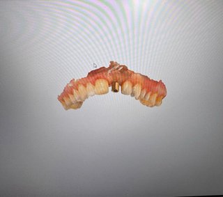 Escaner Intraoral Opera System Mach 2