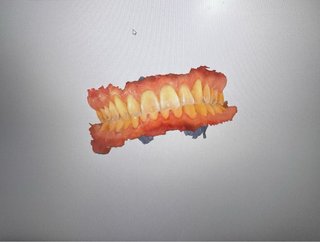 Escaner Intraoral Opera System Mach 2
