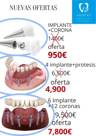 Implante dental precio cerrado
