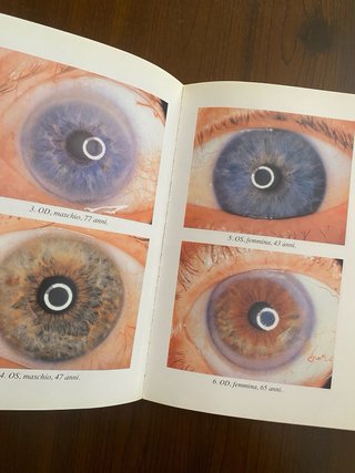 Manuale di iridologia