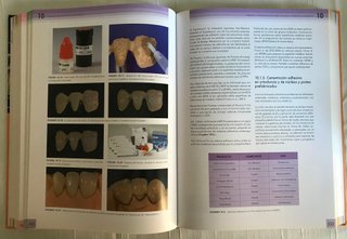 ADHESIÓN EN ODONTOLOGÍA RESTAURADORA.