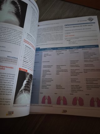 Manual CTO de medicina y cirugía Pediatría