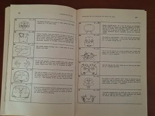 Interpretación de manchas de tinta - Trillas