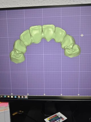 Diseño digital
