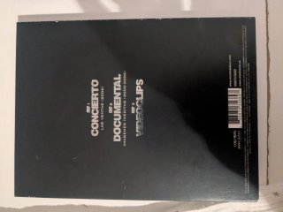 DVD El Canto del Loco - Episodio I
