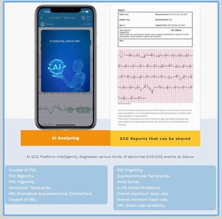Tensiometro Checkme BP2 con electrocardiograma