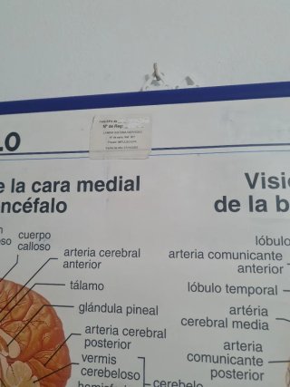 Lámina Anatomía Sistema Nervioso Edigol