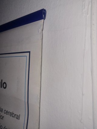 Lámina Anatomía Sistema Nervioso Edigol