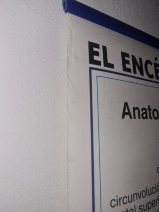 Lámina Anatomía Sistema Nervioso Edigol