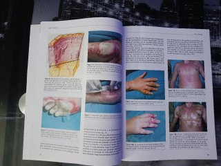 Pack 2 Revistas Medicina FMC Elsevier Doyma