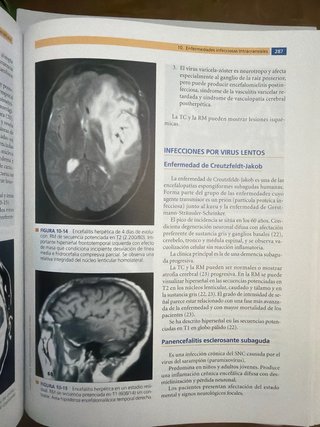 Anatomía humana atlas