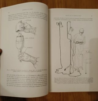 Cirugía de los injertos óseos. Medicina antigua
